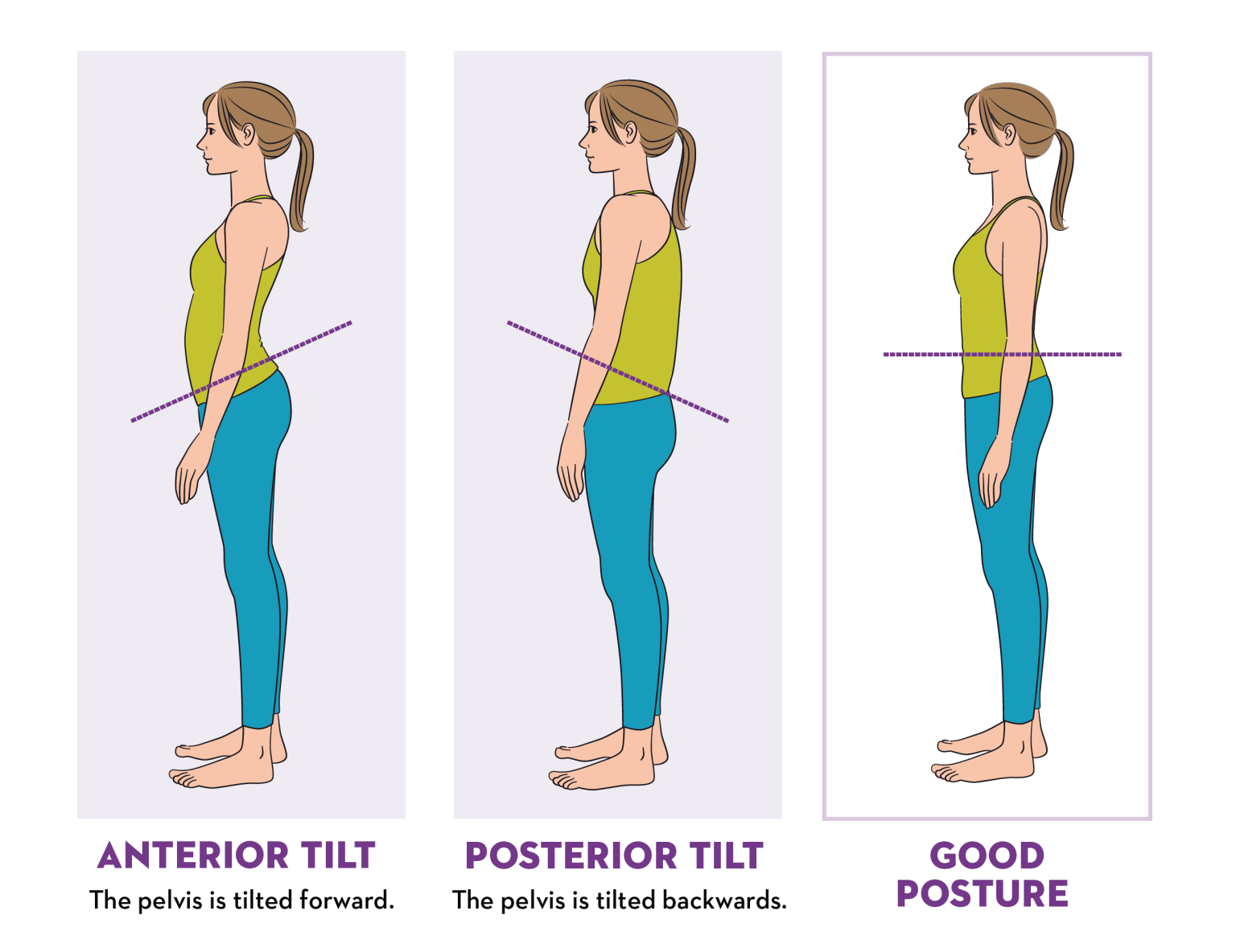 Understanding Pelvic Tilt - Utah Stretch & Flexibility | Midvale, UT